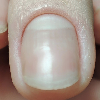 Апаратний манікюр
                    Мастер маникюра Екатерина Белая Церковь