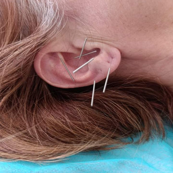 Анна Маноха, Вишнёвое Фото - 4