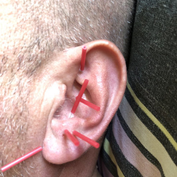 Анна Маноха, Вишнёвое Фото - 6