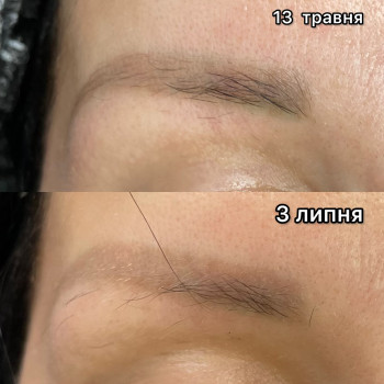 Результат одного видалення