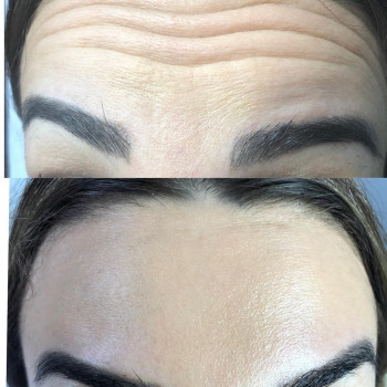 Ольга Черьомухіна, Коростень Фото - 3