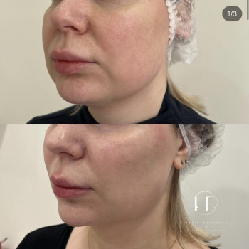 Наталія Рибчинська, Київ Фото - 24