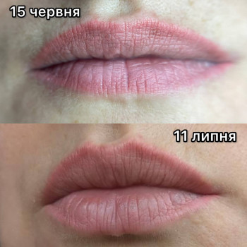 Результат однієї процедури видалення