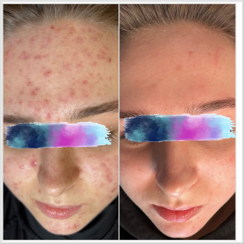 Олена Смульська, Хмельницький Фото - 13