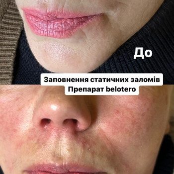 Олена Смульська, Хмельницький Фото - 15