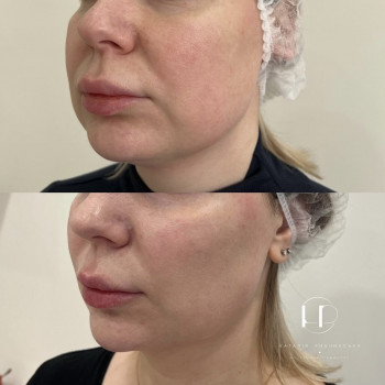 TwAc біо
                    Врач-косметолог Наталия Киев