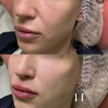 TwAc біо
                    Врач-косметолог Наталия Киев