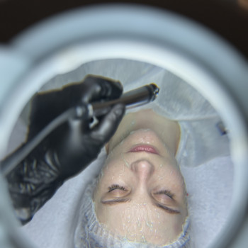 Мікротокова терапія на апараті-T Alvi Prague
                    Косметолог-эстетист Татьяна Днепр