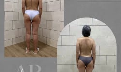 Душ Шарко Салон красоты  Белая Церковь