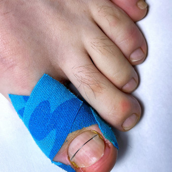 Титанова нитка