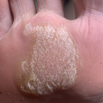 Лариса Фортунская, Одесса Фото - 9