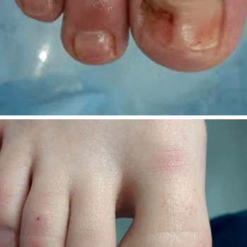 Тетяна Сметанка, Одеса Фото - 27