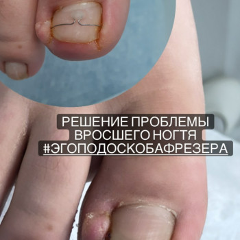 Тетяна Сметанка, Одеса Фото - 28