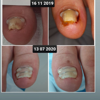 Тетяна Сметанка, Одеса Фото - 30