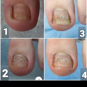 Тетяна Сметанка, Одеса Фото - 31