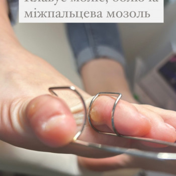 Тетяна Сметанка, Одеса Фото - 33