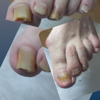 Тетяна Сметанка, Одеса Фото - 34