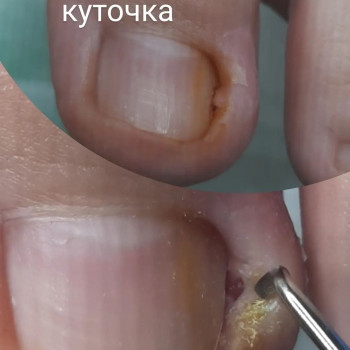 Тетяна Сметанка, Одеса Фото - 35