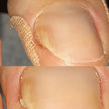 Тетяна Сметанка, Одеса Фото - 36