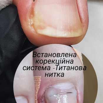 Тетяна Сметанка, Одеса Фото - 37