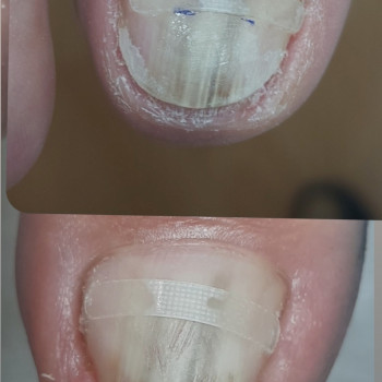 Тетяна Сметанка, Одеса Фото - 39