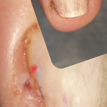 Тетяна Сметанка, Одеса Фото - 40