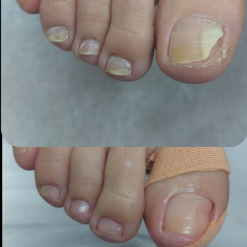 Тетяна Сметанка, Одеса Фото - 41