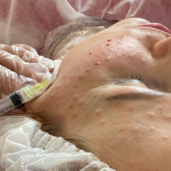 Юлія Дегтярьова, Одеса Фото - 6