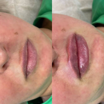 Юлія Дегтярьова, Одеса Фото - 9