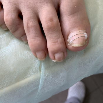 Ирина Фомина, Кривой Рог Фото - 4