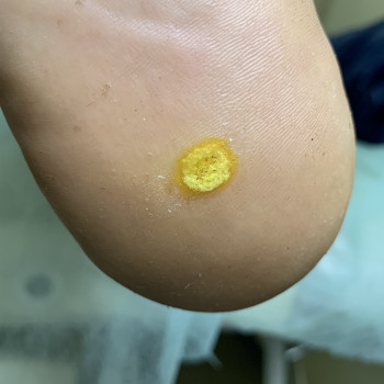 Ирина Фомина, Кривой Рог Фото - 10