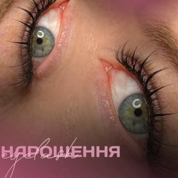 Снежана Шевчук, Хмельник Фото - 11