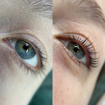 Ламінування вій
                    Бровіст Елена Дніпро