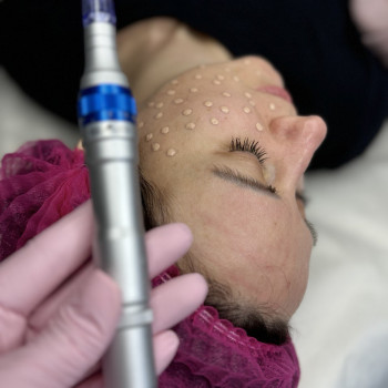 Процедура BB glow
Ви забудете що таке тональний крем, не буде необхідності його використовувати