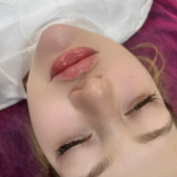 Бьютификация губ # + коррекция подбородка #