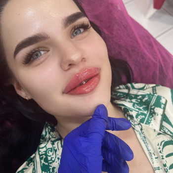 Увеличитьгубы #