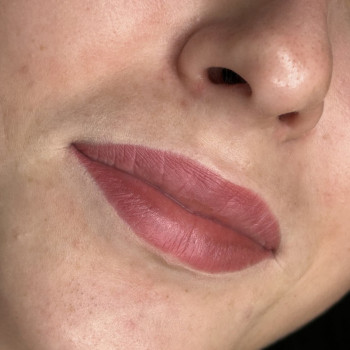 Загоєний перманент