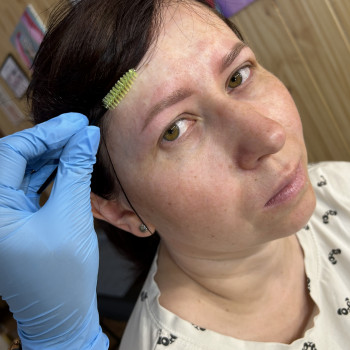 Загоєні перед корекцією