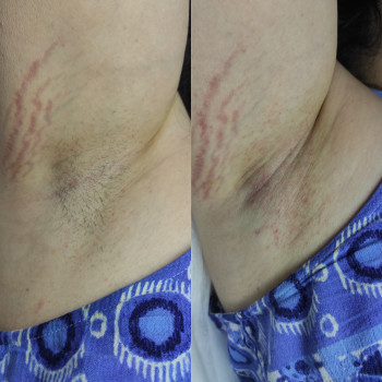 Валентина , Дніпро Фото - 3