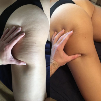 Фото из портфолио мастера Филипп Черногал (массажист, Днепр)