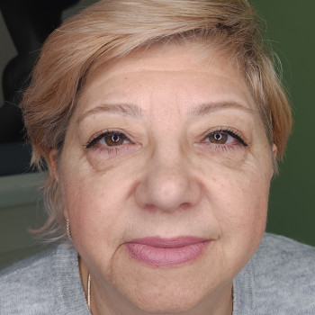 Перекрытие старого Татуажа - до