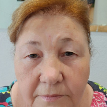 Очень сложная работа -у клиентки сильная асимметрия бровей