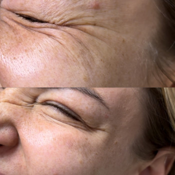 Катерина Хомутовська, Харьков Фото - 4