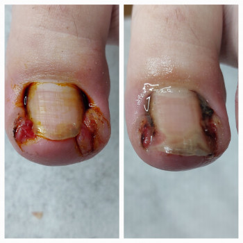 Тетяна Сметанка, Одеса Фото - 3