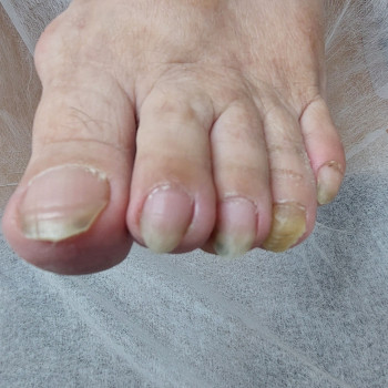 Тетяна Сметанка, Одеса Фото - 4