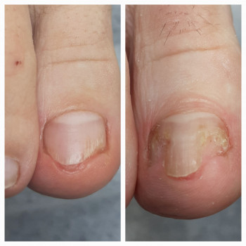 Тетяна Сметанка, Одеса Фото - 6