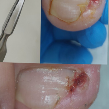 Тетяна Сметанка, Одеса Фото - 7