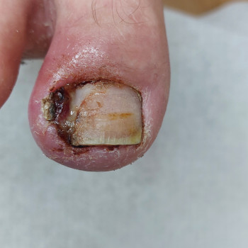 Тетяна Сметанка, Одеса Фото - 14