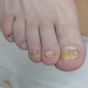 Тетяна Сметанка, Одеса Фото - 15