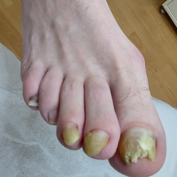 Тетяна Сметанка, Одеса Фото - 16